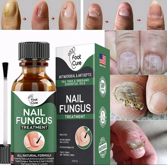 Nail Fungus Treatment Serum 10ml